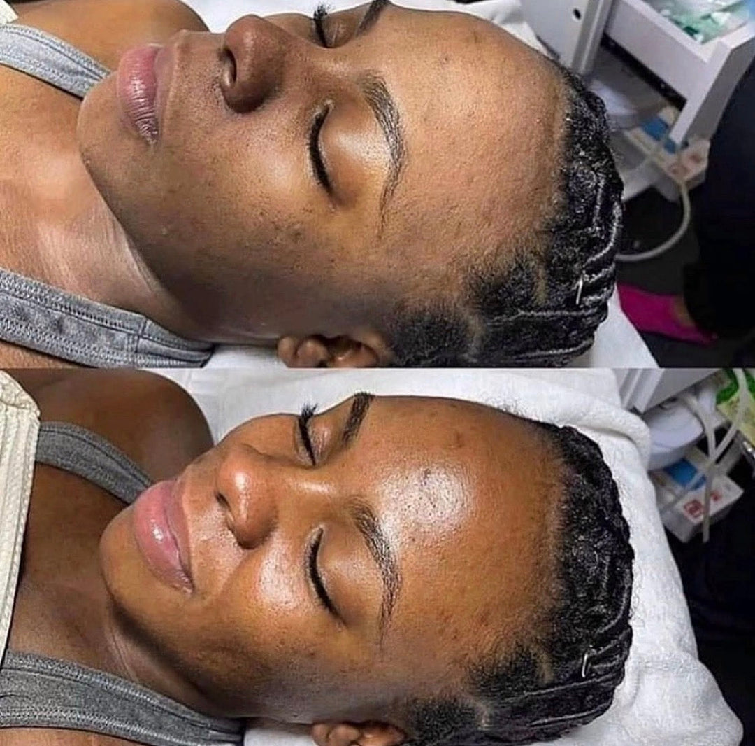 Smooth Skin Starts Here